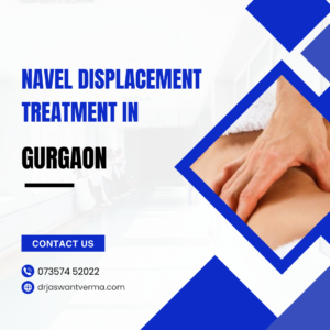 Navel displacement