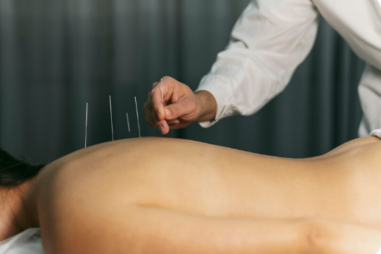 cupping therapy supports muscle recovery can help you enhance performance and speed up healing.